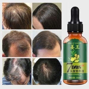 Ginger Hair Growth Essential Oil 30ml